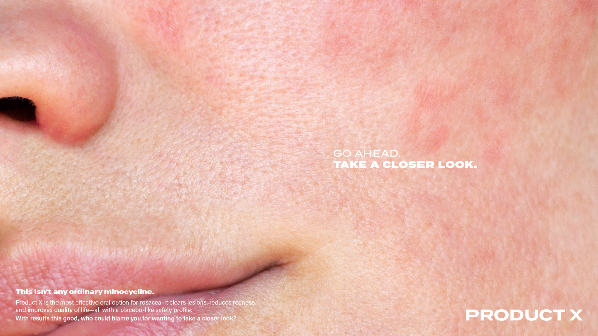 Tested Emrosi concept featuring a close-up of a patient’s skin
